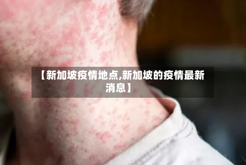 【新加坡疫情地点,新加坡的疫情最新消息】-第2张图片