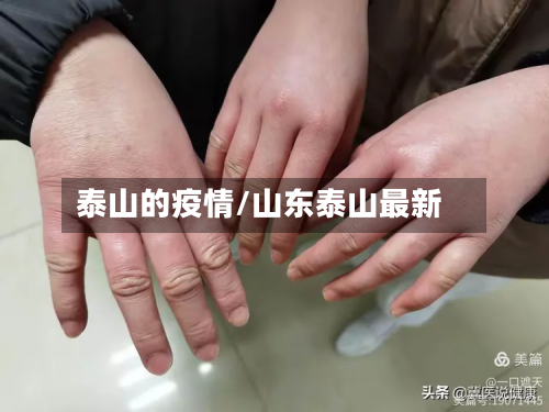 泰山的疫情/山东泰山最新-第2张图片